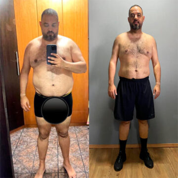 Resultado Antes e Depois - Protocolo 8w