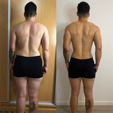 Resultado Antes e Depois - Protocolo 8w